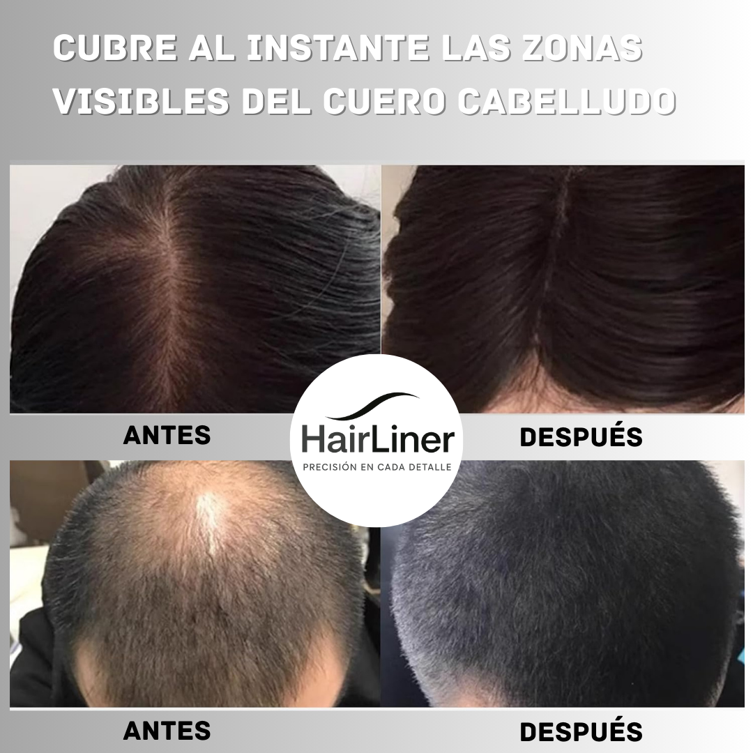 HAIRLINER | CONFIANZA QUE SE NOTA